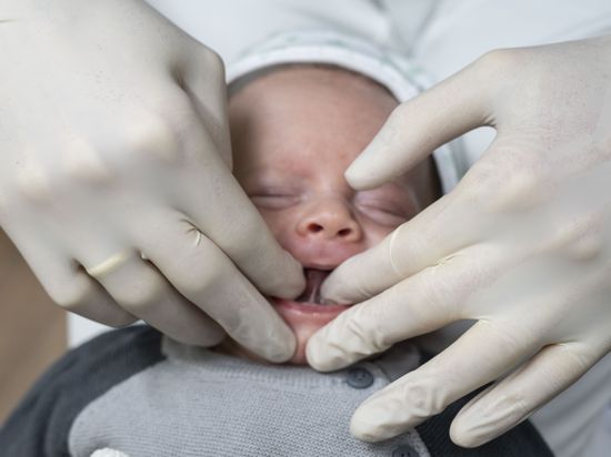 Zwei behandschuhte Hände greifen einem Säugling in den Mund und legen das Zungenbändchen frei.