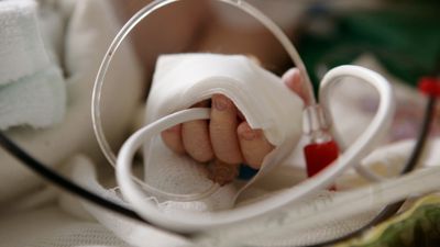 Kleiner Patient: Marie Müllers Sohn bekommt nach der Geburt eine Lungenentzündung. Er hängt mehrere Wochen an einem Beatmungsgerät in der Kinderklinik in Landau.