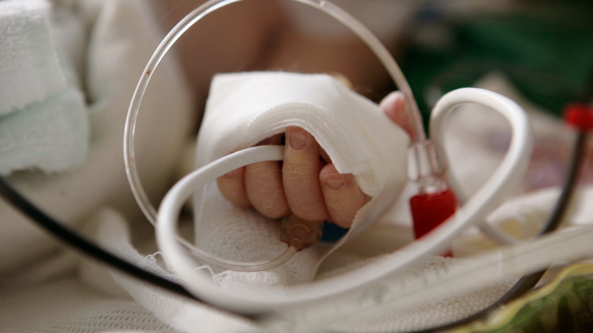 Marie Müllers Sohn bekommt nach der Geburt eine Lungenentzündung. Er hängt mehrere Wochen an einem Beatmungsgerät in der Kinderklinik in Landau.