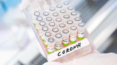 Eine biologisch-technische Assistentin zeigt aufbereitete PCR-Tests auf das Corona-Virus von Patienten im PCR-Labor vom Niedersächsischen Landesgesundheitsamt (NLGA). +++ dpa-Bildfunk +++