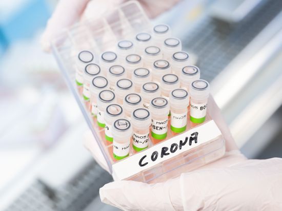 Eine biologisch-technische Assistentin zeigt aufbereitete PCR-Tests auf das Corona-Virus von Patienten im PCR-Labor vom Niedersächsischen Landesgesundheitsamt (NLGA). +++ dpa-Bildfunk +++