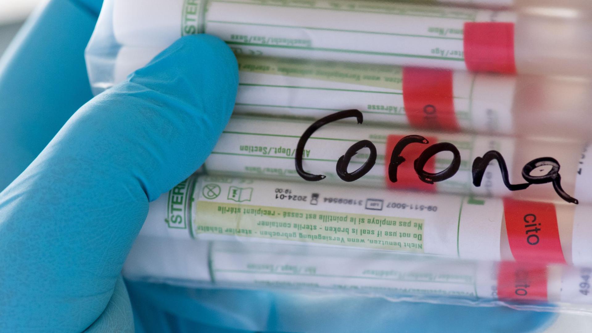 Proben für Corona-Tests werden einem Labor für die weitere Untersuchung vorbereitet.