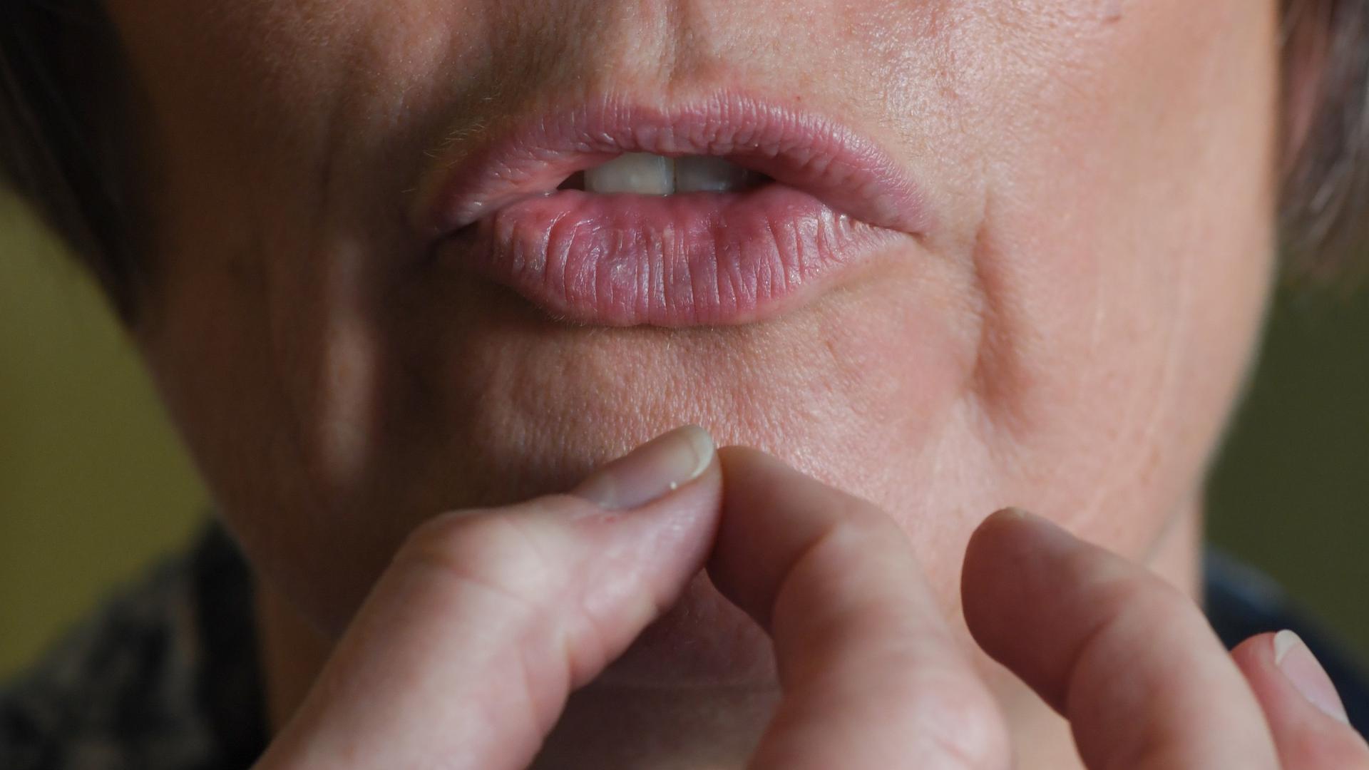 Die Lippen einer Logopädie-Patientin formen sich zu einem Laut.