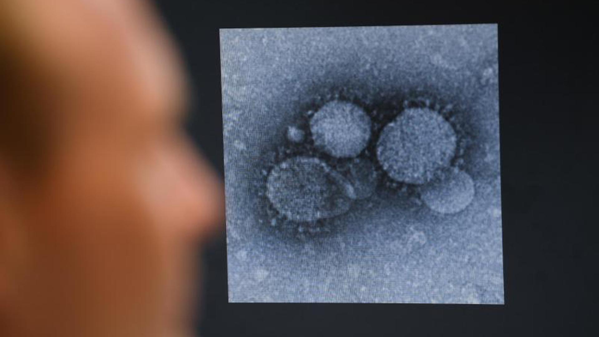 Ein Virologe betrachtet den MERS-Coronavirus
