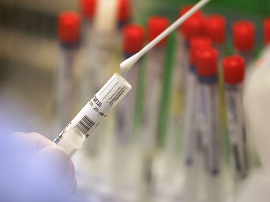 Ein Abstrich wird in einem Labor auf das Coronavirus untersucht.