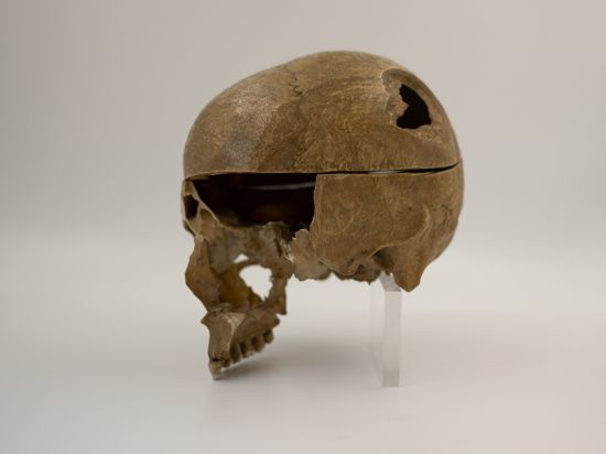 Schädel mit einem Loch an der Schädeldecke, kaum Gesichtsknochen