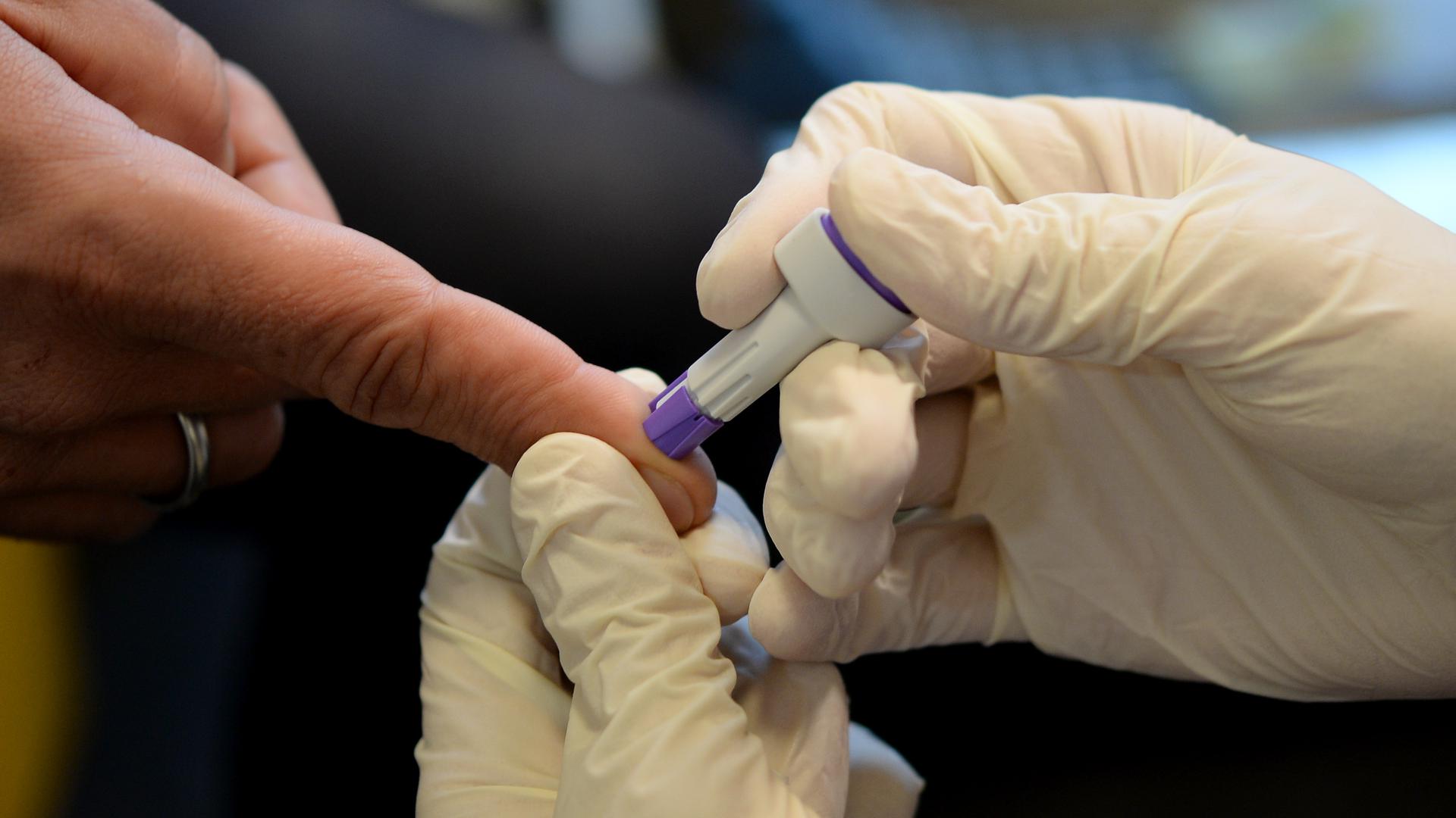 Ein Arzt nimmt bei der Berliner Aids-Hilfe e.v. an dem Finger eines jungen Mannes Blut ab. (Zu dpa "HIV: Weniger Neuinfektionen, aber Tausende unwissentlich positiv") +++ dpa-Bildfunk +++