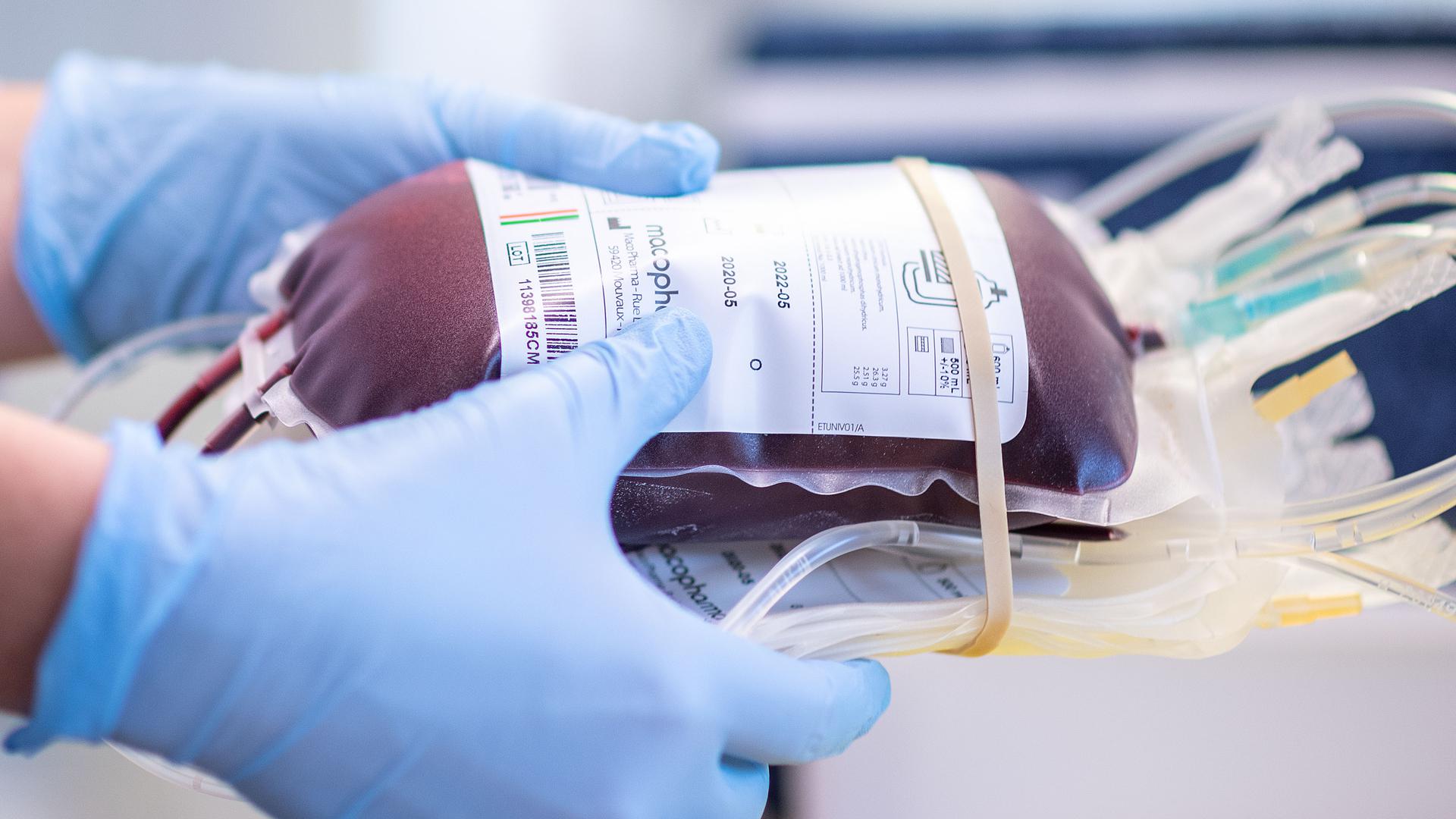 Eine Mitarbeiterin des Blutspendezentrums des Deutschen Roten Kreuzes hält eine Blutkonserve in den Händen. Spenderblut ist auch in der Corona-Pandemie wichtig. Darauf will NRW-Gesundheitsminister Laumann mit Vertretern des Deutschen Roten Kreuzes (DRK) und der Uniklinik aufmerksam machen. +++ dpa-Bildfunk +++