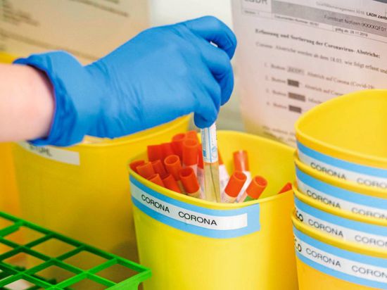 Große Herausforderung: Da Labore in Deutschland offenbar an ihre Grenzen in Sachen Testkapazitäten stoßen, geht das Gesundheitsamt Offenburg von einer deutlich größeren Zahl an Corona-Infizierten als gemeldet aus.