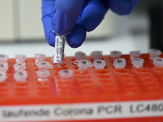Eine Mitarbeiterin des PCR Testlabors des Robert Bosch Krankenhauses bereitet PCR Tests vor. 