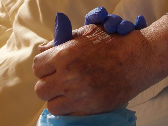 Die Hand von Bettina Oster im blauen Schutzhandschuh umschließt die Hand ihres Vaters.