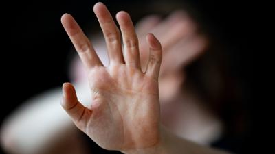 Eine Frau hält ihre Hände vor das Gesicht (zu dpa «Fast 2000 Menschen beantragen in NRW Opferentschädigung - zunehmend nach Sexualstraftaten»), (Gestellte Szene) +++ dpa-Bildfunk +++