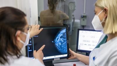 Mammopraphie Krebs Massenscreening