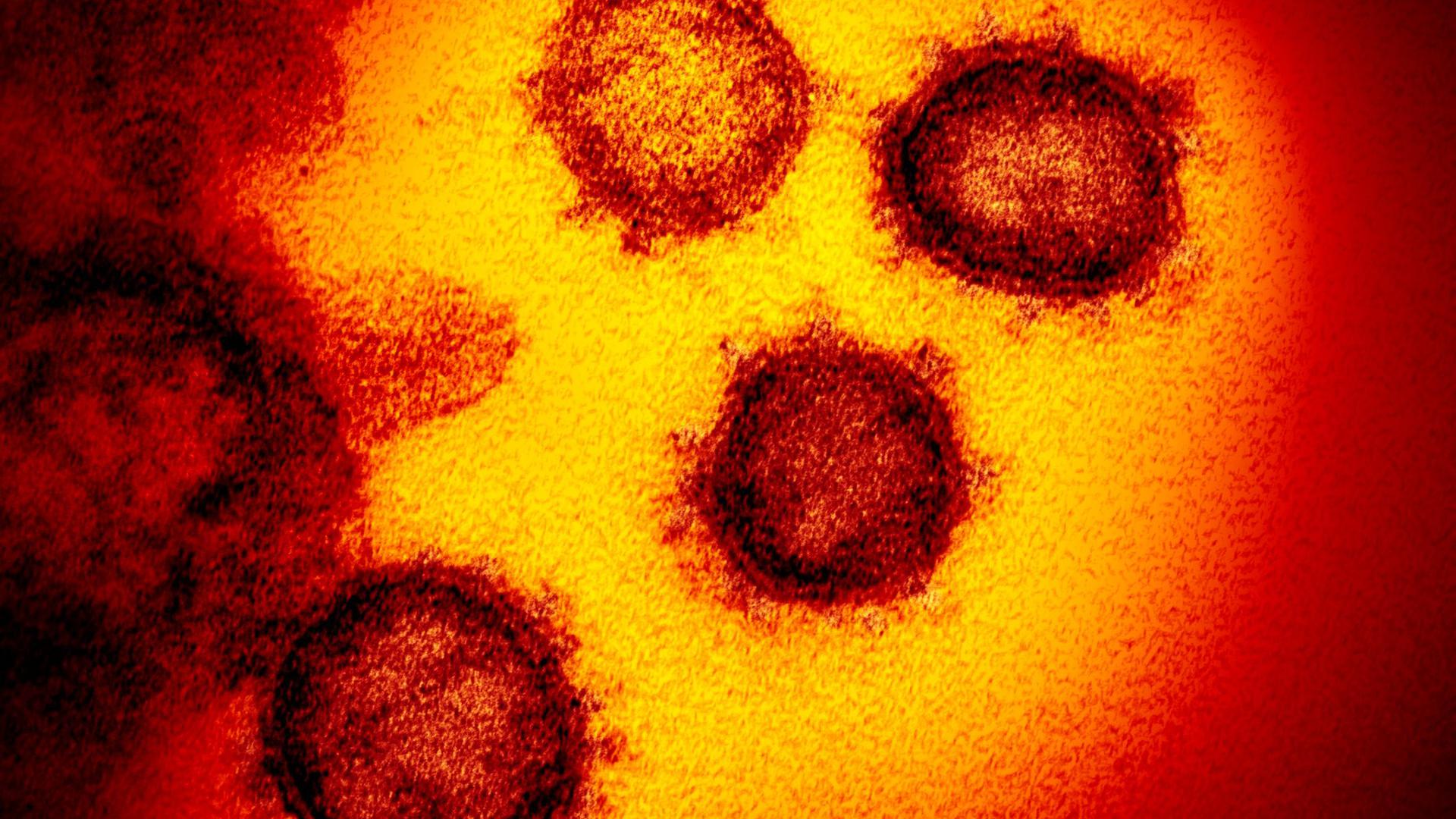 Eine undatierte elektronenmikroskopische Aufnahme des Coronavirus (SARS-CoV-2).