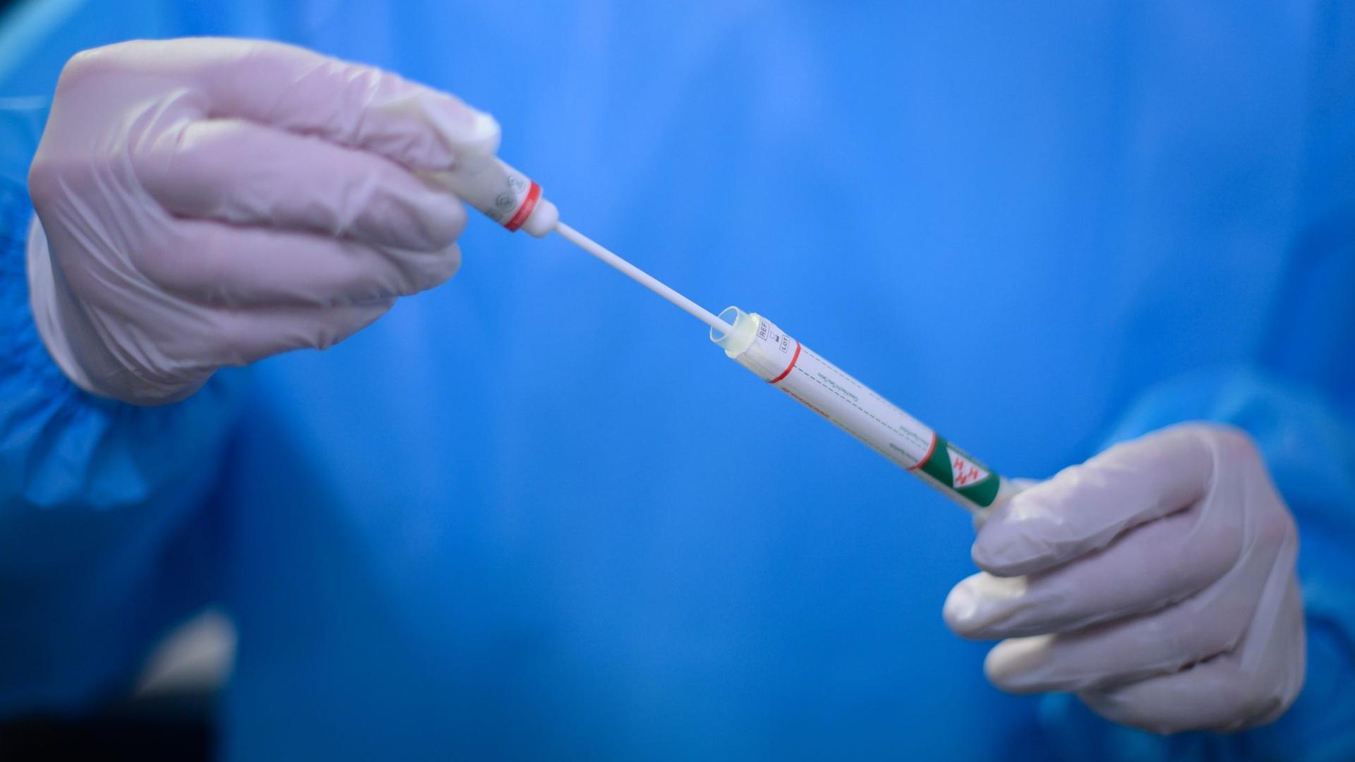 Ein Arzt hält einen Coronavirus-Test in den Händen.