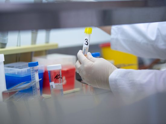 Eine Ärztin zeigt in einem Labor einen Test für das Coronavirus.