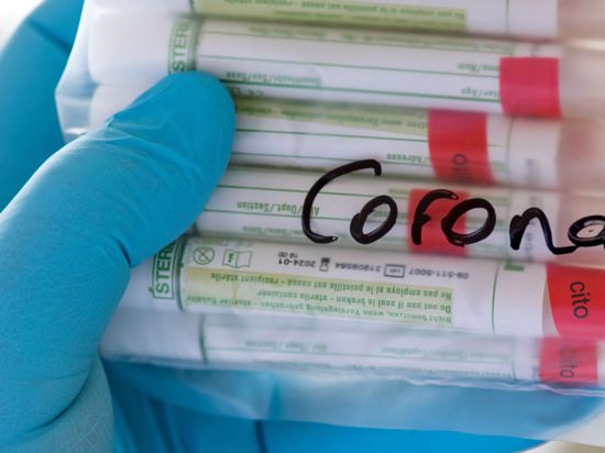Proben für Corona-Tests werden untersucht.