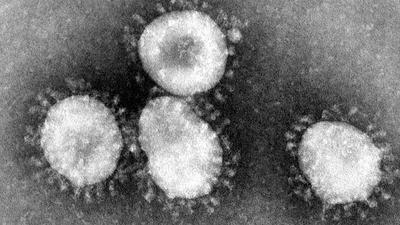 Ein Coronavirus unter dem Mikroskop.
