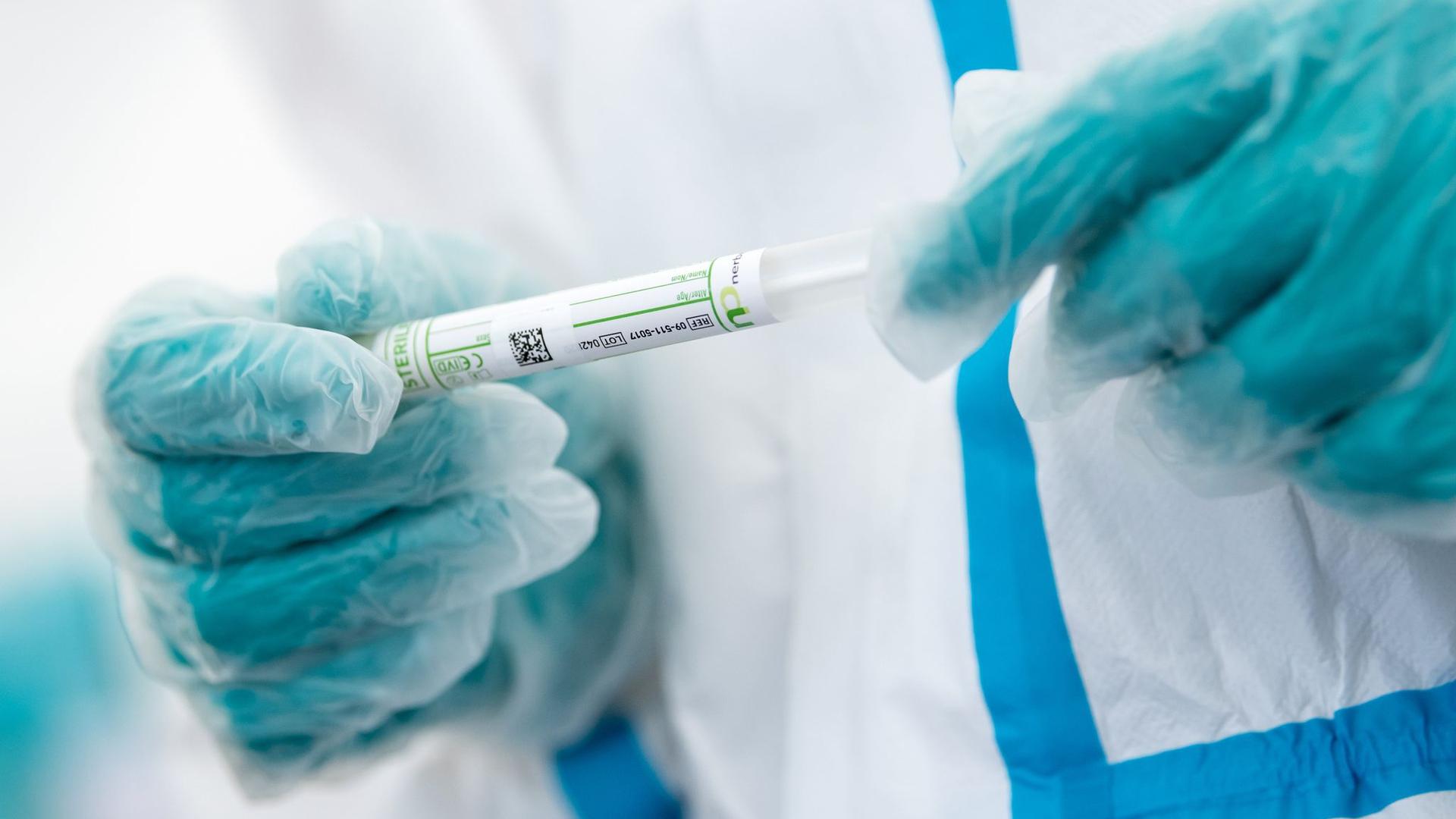Ein medizinischer Mitarbeiter hält ein Teströhrchen mit einem Abstrich für einen Corona-Test in den Händen.