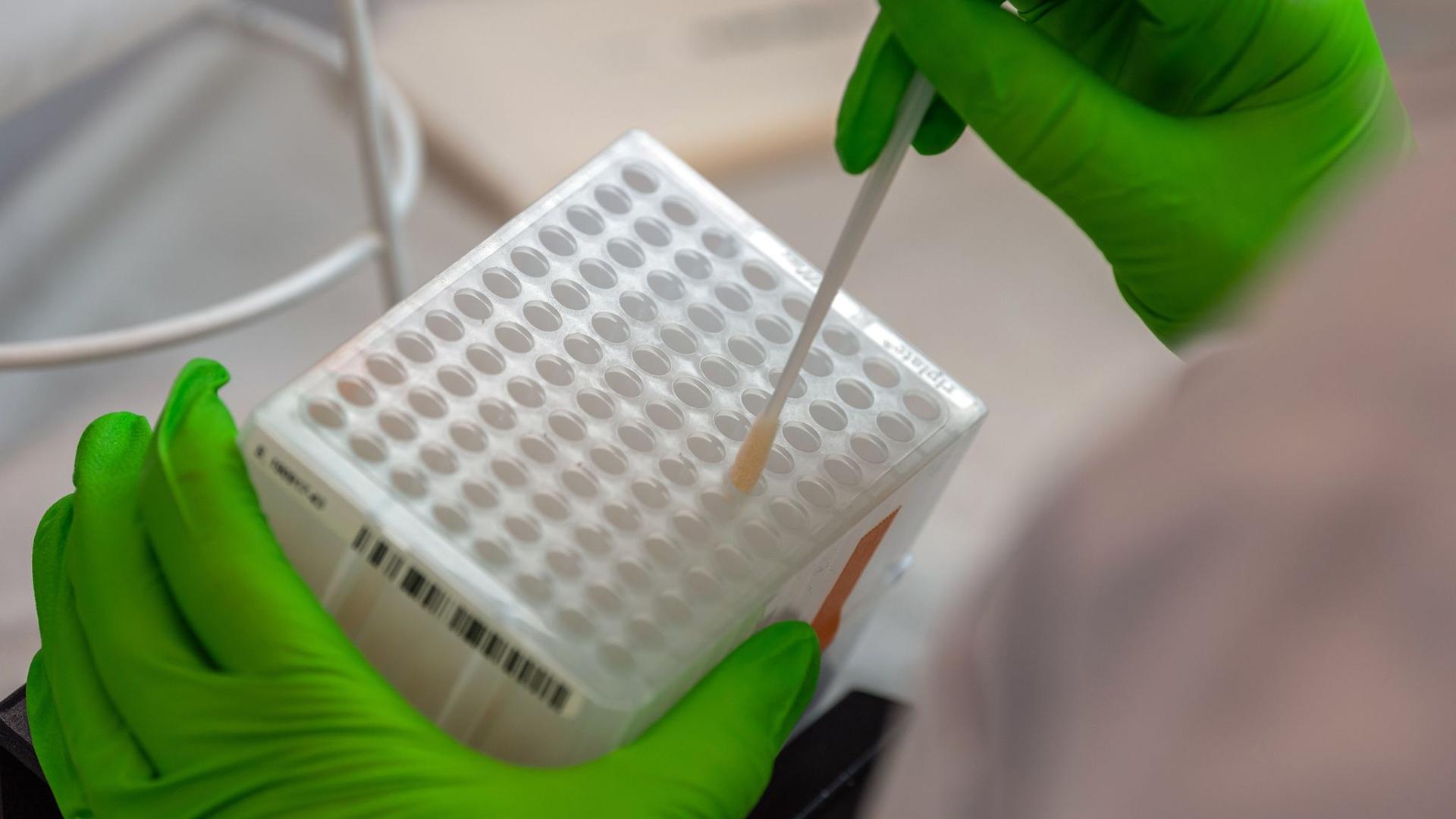 Eine Mitarbeiterin sortiert medizinischen Wattestäbchen für den Typisierungsprozess der DNA.