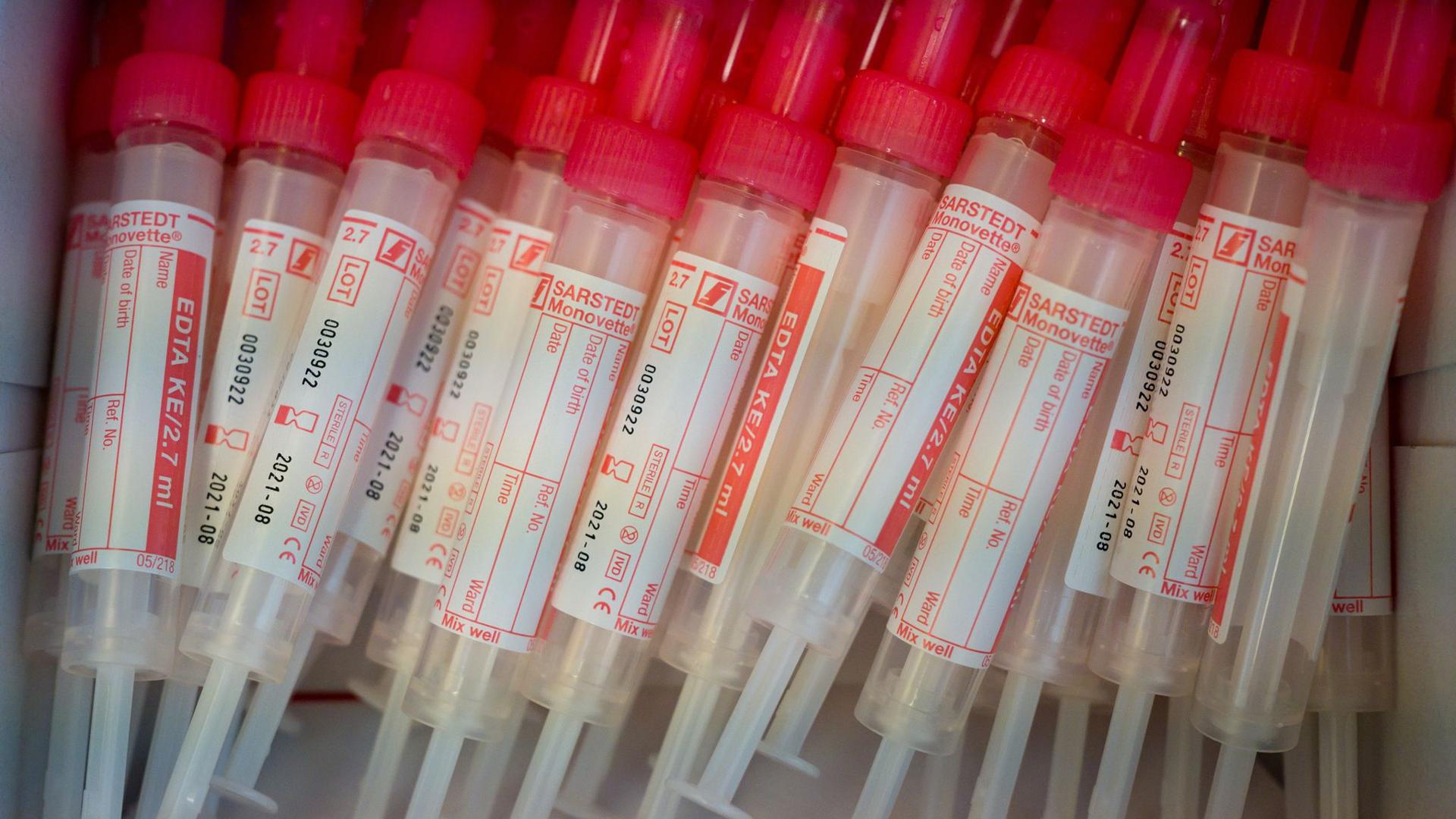 Proberöhren für die Blutentnahme liegen in einer Verpackung. Jeder soll sich in Bayern auf das Corona-Virus testen lassen können.
