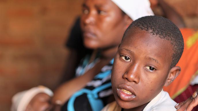 Der 13-jährige Elia aus Tansania ist an Katarakt (Grauer Star) erblindet. Er hofft auf eine Operation im KCMC-Hospital, das von der deutschen Hilfsorganisation CBM unterstützt wird. Seine Hoffnung: Wieder in die Schule gehen zu dürfen. Und endlich einmal sei jüngste Schwester mit eigenen Augen sehen.
