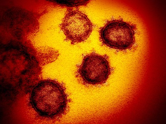 Die Elektronenmikroskopaufnahme zeigt das Coronavirus SARS-CoV-2.
