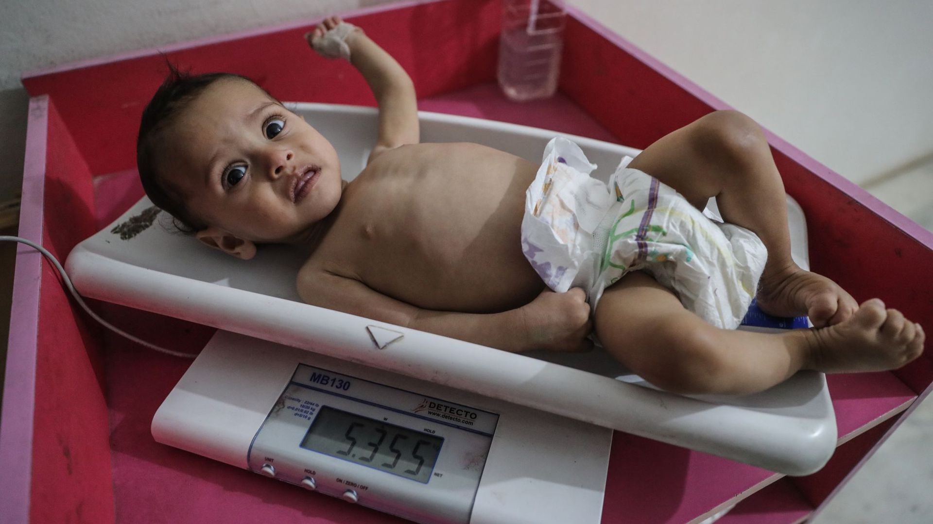 Eine Krankenschwester ermittelt das Gewicht eines unterernährten Kindes im Ibn Sina Krankenhaus in Idlib. (Archivbild)