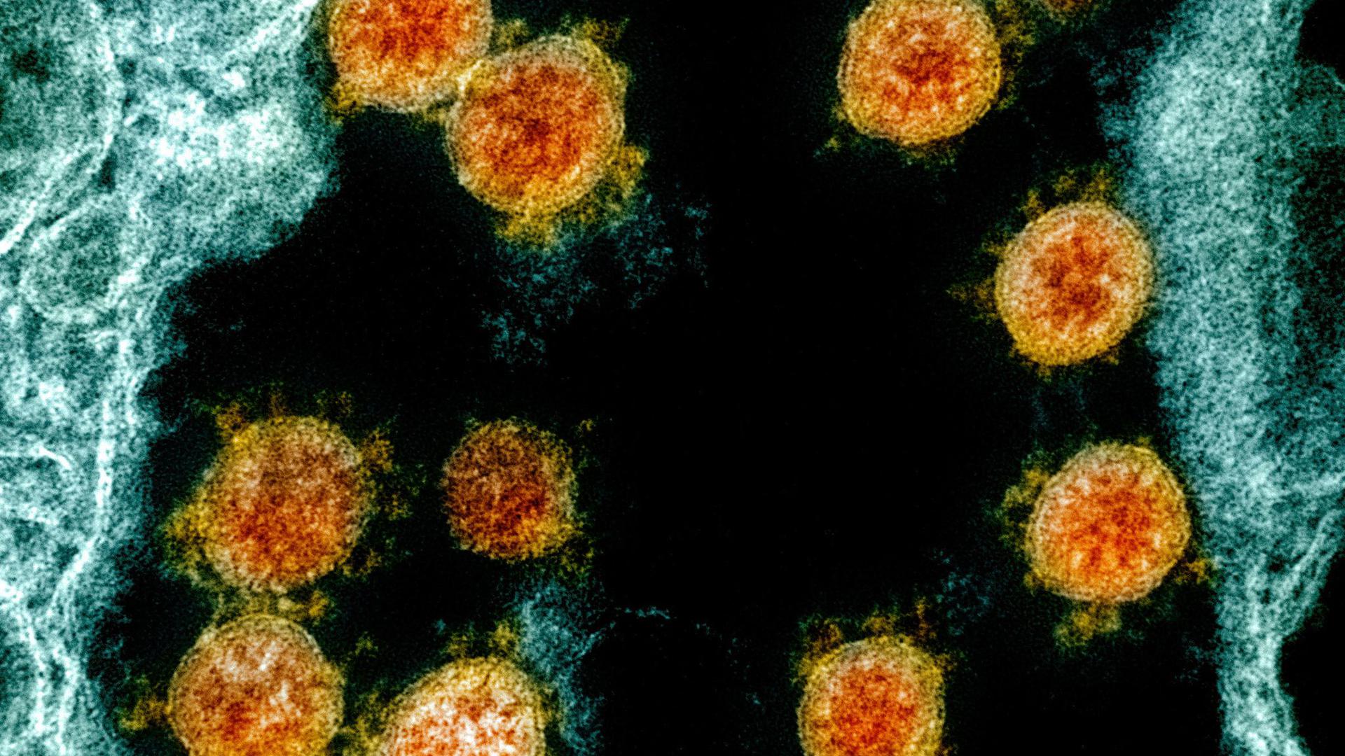 Elektronenmikroskopische Aufnahme von Partikeln des Coronavirus SARS-CoV-2.