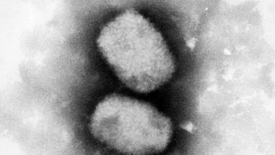 Diese vom Robert Koch-Institut (RKI) zur Verfügung gestellte elektronenmikroskopische Aufnahme zeigt das Affenpockenvirus. In Großbritannien sind vier weitere Fälle erfasst worden.