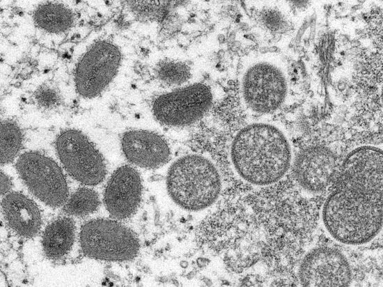 Diese elektronenmikroskopische Aufnahme aus dem Jahr 2003 zeigt reife, ovale Affenpockenviren (l) und kugelförmige unreife Virionen (r).