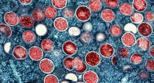 Eine kolorierte transmissionselektronenmikroskopische Aufnahme von Partikeln des Affenpockenvirus (rot) in einer infizierten Zelle (blau), die im Labor gezüchtet wurde.