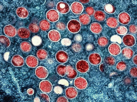 Eine kolorierte transmissionselektronenmikroskopische Aufnahme von Partikeln des Affenpockenvirus (rot) in einer infizierten Zelle (blau), die im Labor gezüchtet wurde.