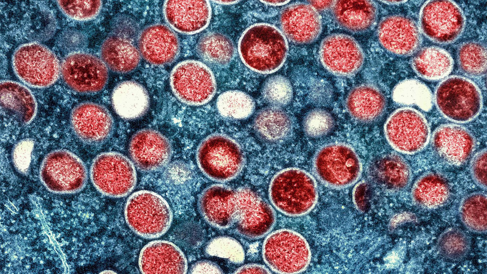 Partikel des Affenpockenvirus (rot) in einer infizierten Zelle (blau).