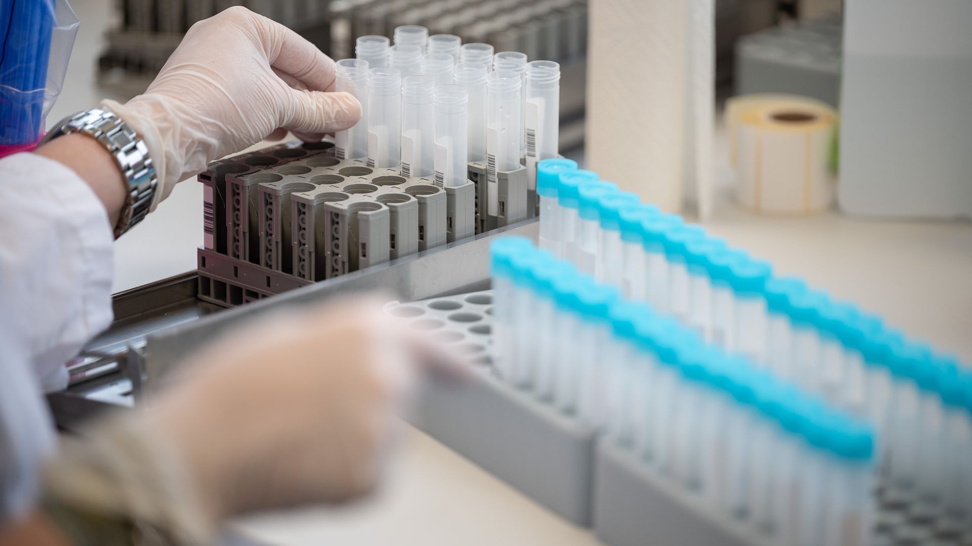 Eine Labormitarbeiterin bereitet im Bioscientia MVZ Labor Mittelhessen Teströhrchen für einen PCR-Test vor. Mittels PCR-Corona-Test kann in einer Probe zuverlässig nachgewiesen werden, ob Erreger vorhanden sind. +++ dpa-Bildfunk +++